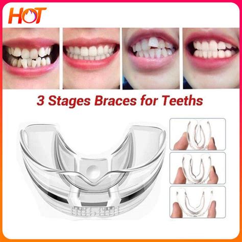 smicare alignment|3 in1 Smicare Teeth Alignment Set 3 Stages  .